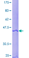 12.5% SDS-PAGE Stained with Coomassie Blue.